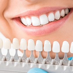 Woman smiling with bright white Veneers
