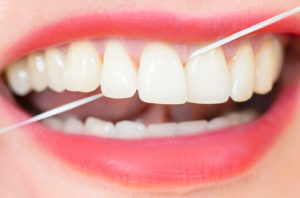 Traditional Floss versus Floss Picks