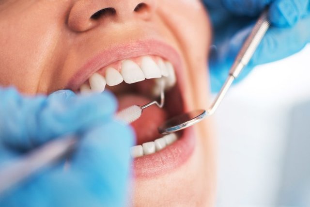 dental cleaning by hygienist