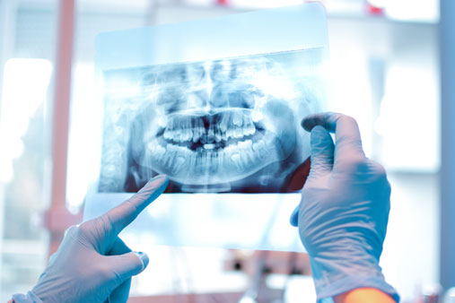 pointing to dental xray