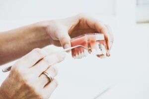 hand pointing to abutment on fake teeth