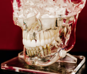 dental implant