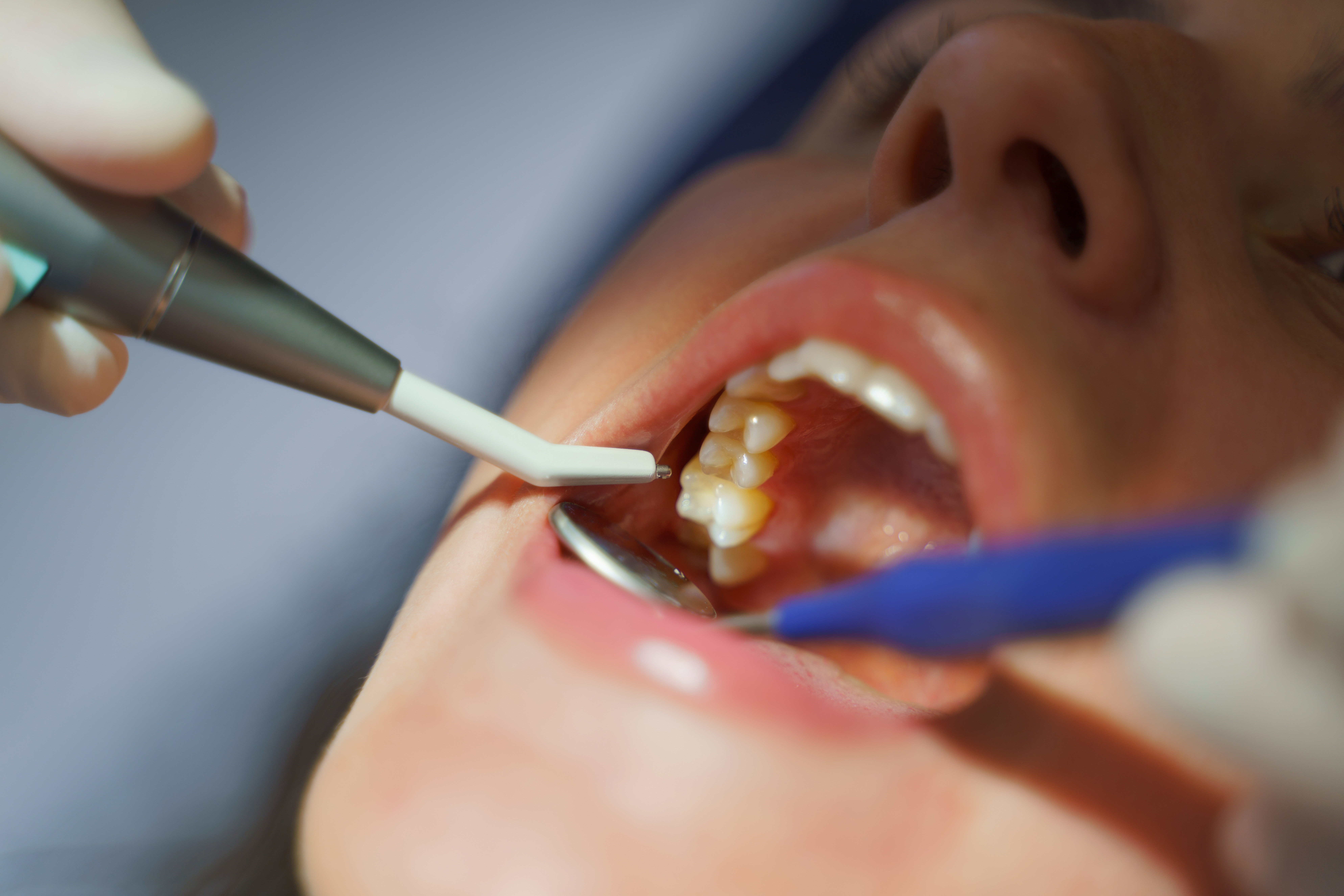 dental exam